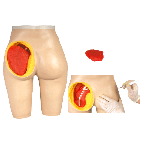 高級(jí)臀部肌肉注射與解剖結(jié)構(gòu)模型 高級(jí)臀部肌肉注射與解剖結(jié)構(gòu)模型