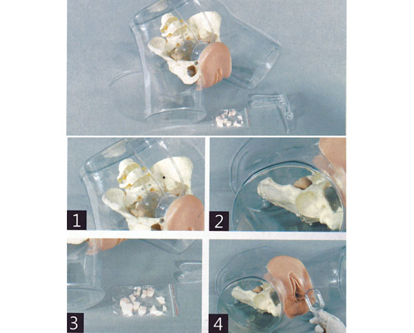 高級透明刮宮模型 高級透明刮宮模型