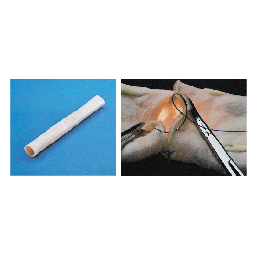 腸管吻合模型(30mm) 腸管吻合模型(30mm)