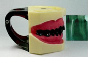 口腔X線攝片模型 口腔X線攝片模型