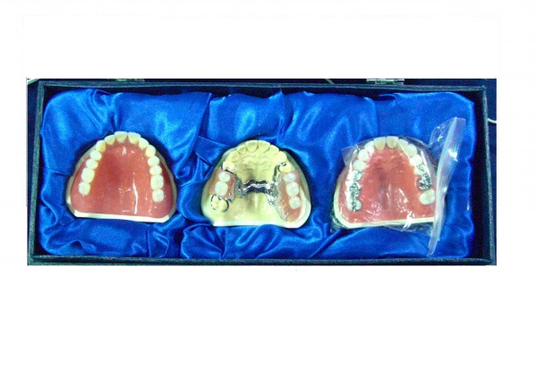 口腔修復(fù)套裝模型 口腔修復(fù)套裝模型